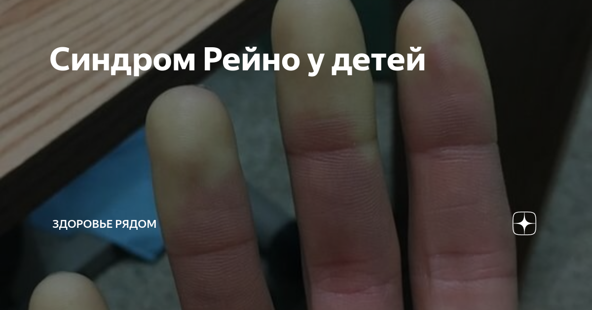 Синдром Рейно у детей | Здоровье рядом | Дзен