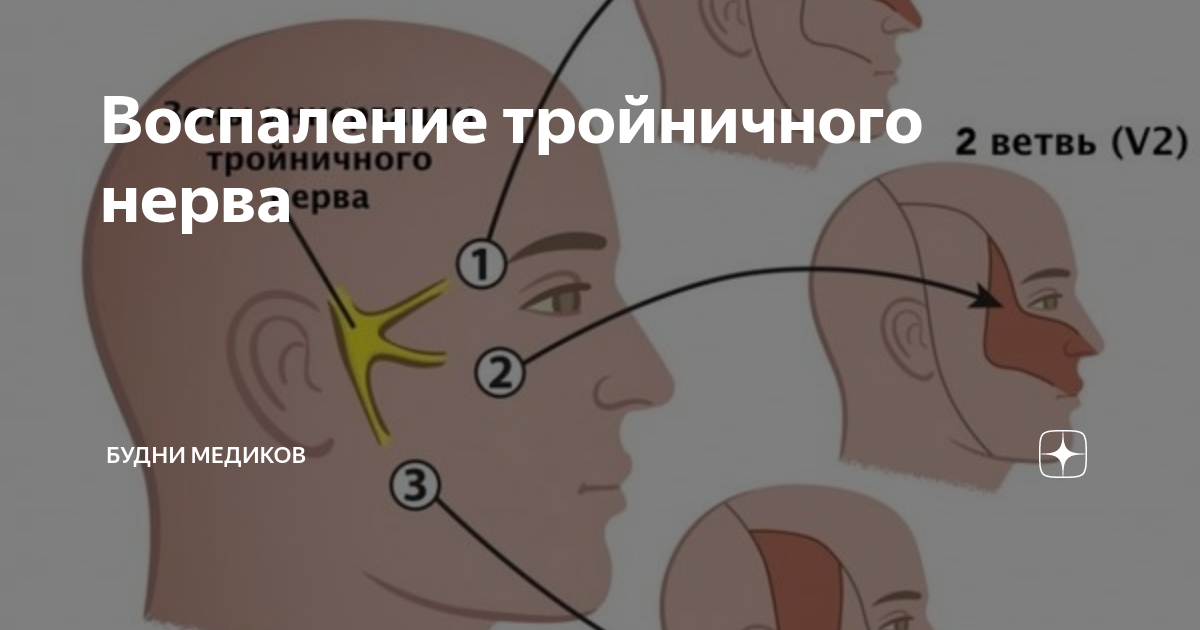 Препараты при невралгии тройничного нерва | Лечение невралгии в Москве в клинике «Тибет»