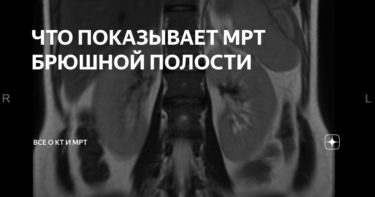 Что можно есть перед мрт брюшной полости