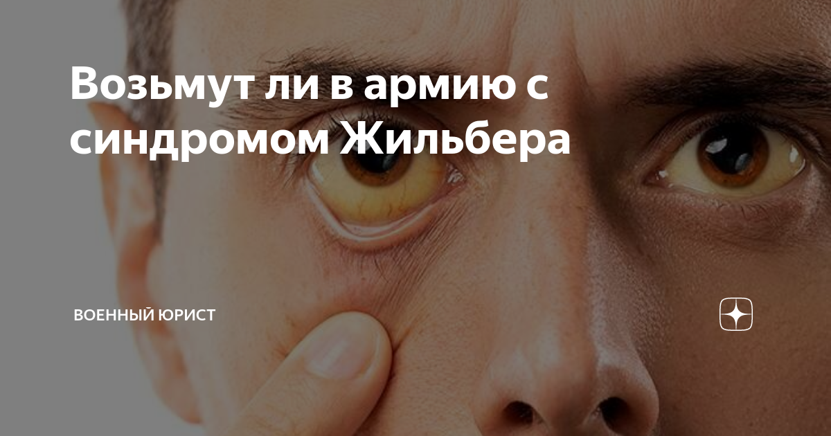Синдром жильбера клинические симптомы. Болезнь жильбера симптомы. Стол при синдроме жильбера. Синдром жильбера симптомы. Синдром жильбера симптомы.