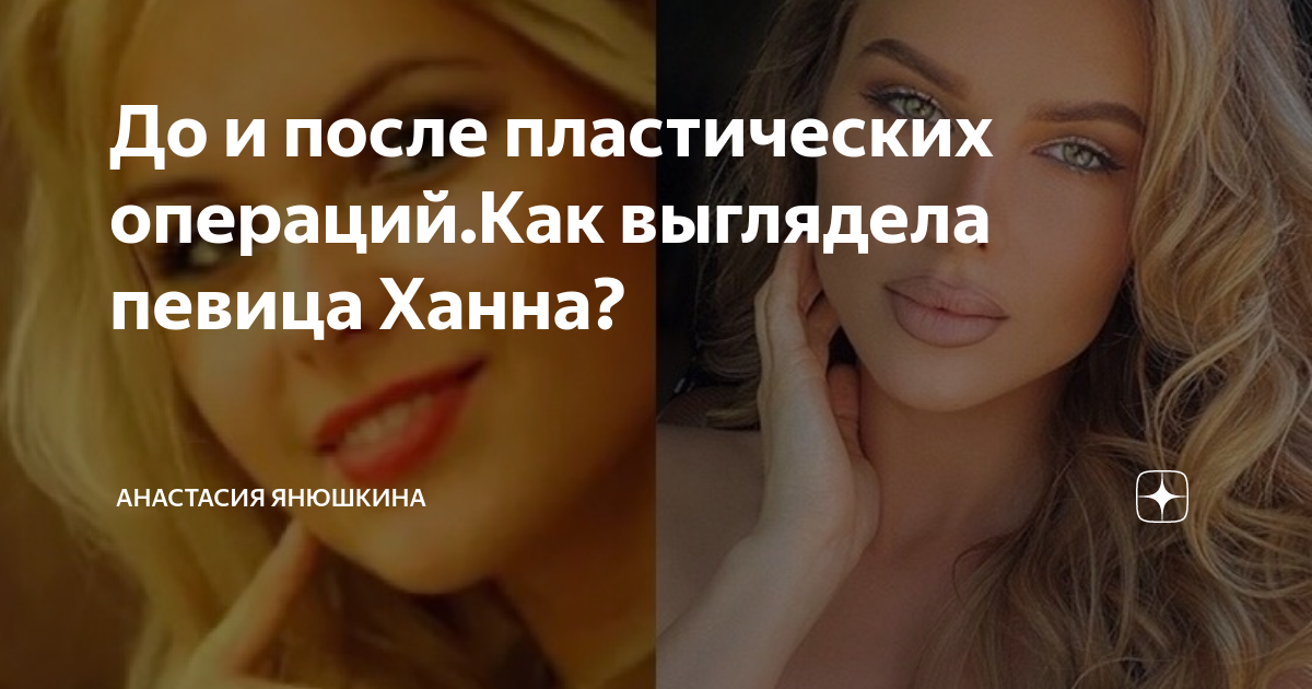 Ханна до операции и после фото пластические До и после пластических операций.Как выглядела певица Ханна Анастасия Янюшкина