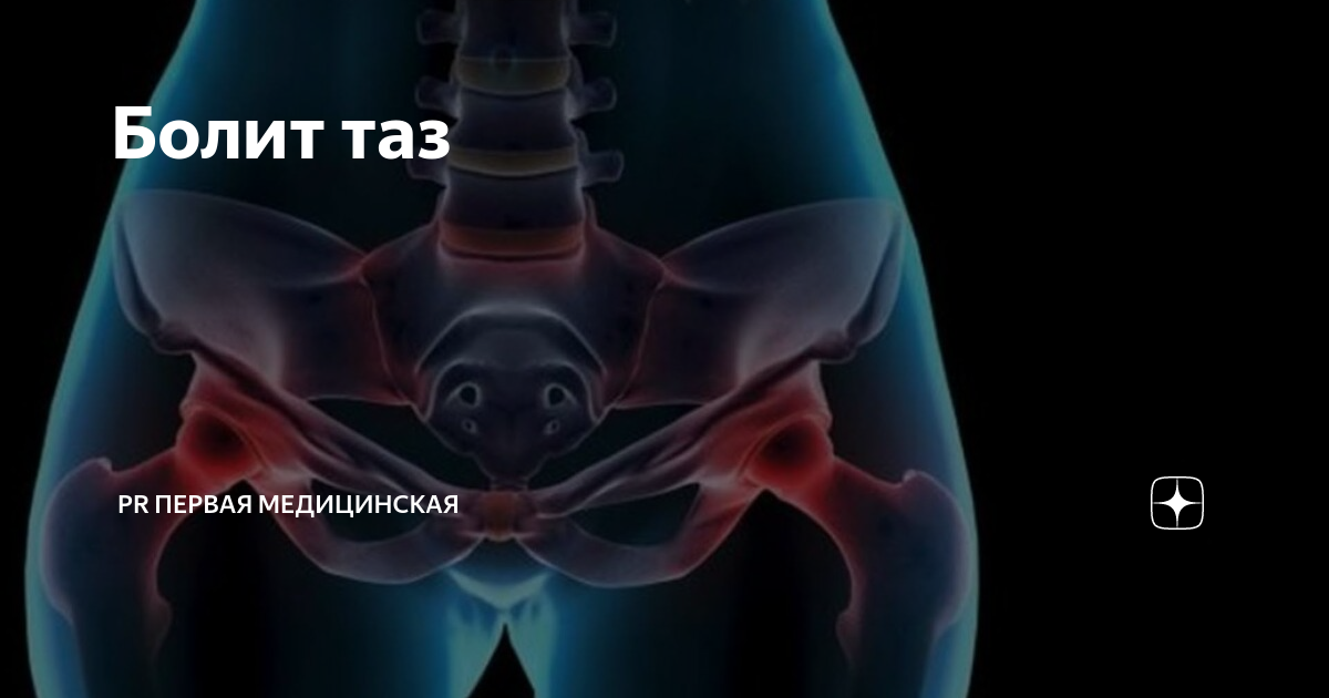 Симптом Штернберга при мезадените. Лечение мезаденита народными средствами. Болит тазовая кость справа