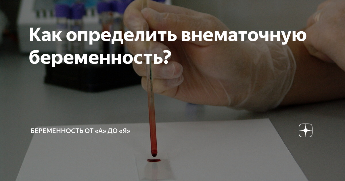 Первые признаки внематочной беременности до задержки – клиника «Здоровая семья»