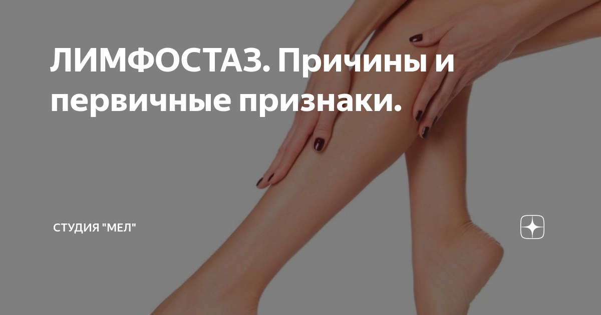 А Вы уверены что у Вас есть ожирение? Лимфатические отеки Путь к себе Дзен