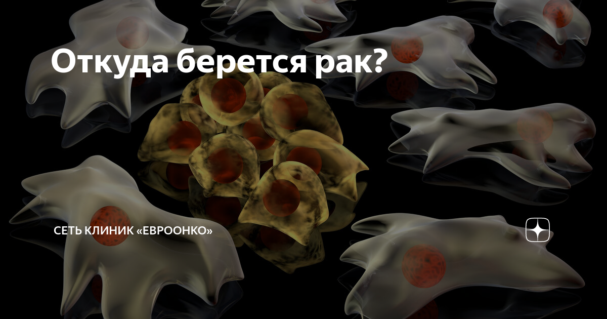 Откуда берется рак? | Сеть клиник «Евроонко» | Дзен