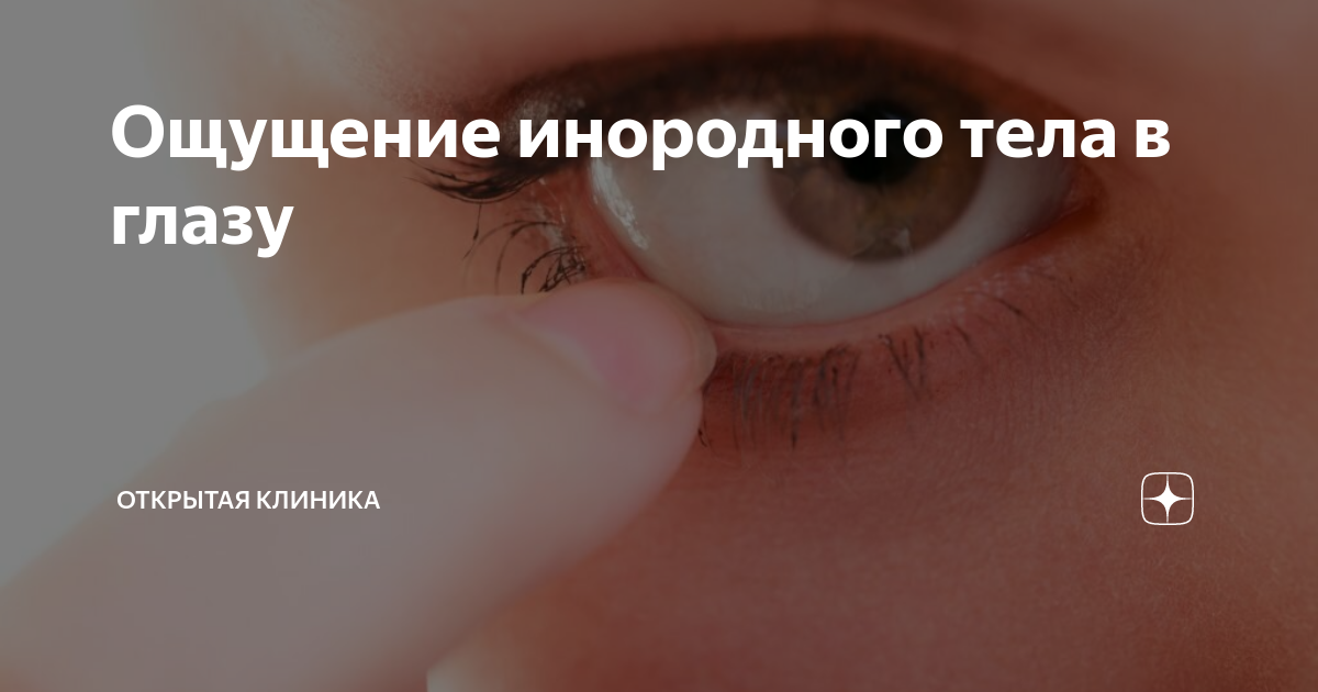Ощущение инородного тела в глазу | Открытая Клиника | Дзен