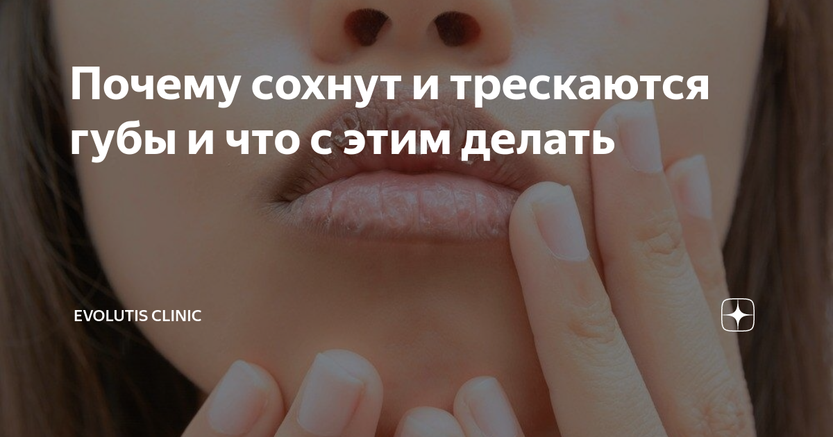 Фразеологизм молоко на губах не обсохло значение