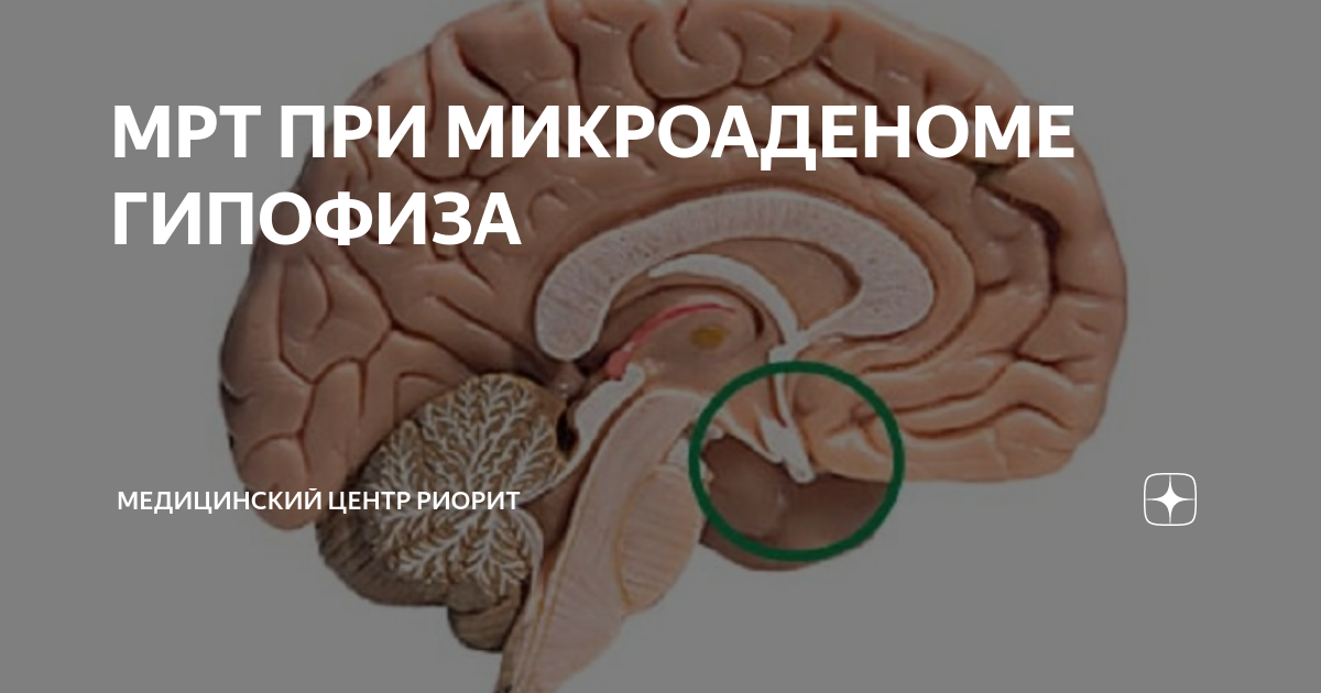 Риорит мрт центр. Риорит мрт центр. Медцентр риорит руставели 66. Спб ул руставели 66 мрт центр. Риорит мрт центр.