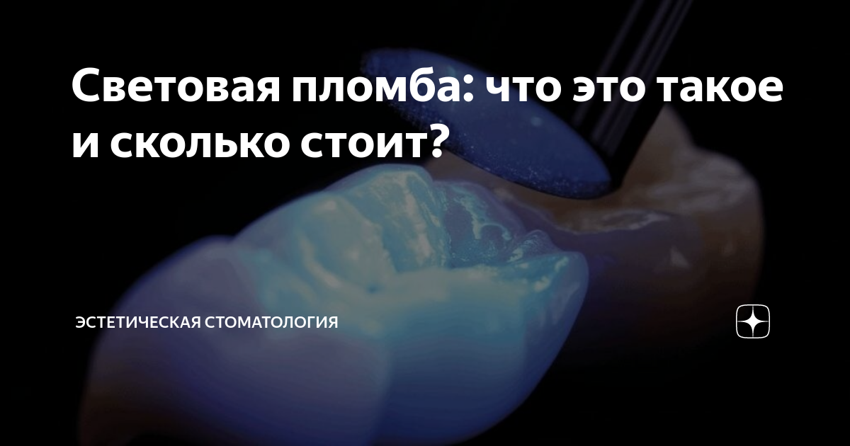 Световая пломба: что это такое и сколько стоит? | ГК «ЦСИ» | Дзен