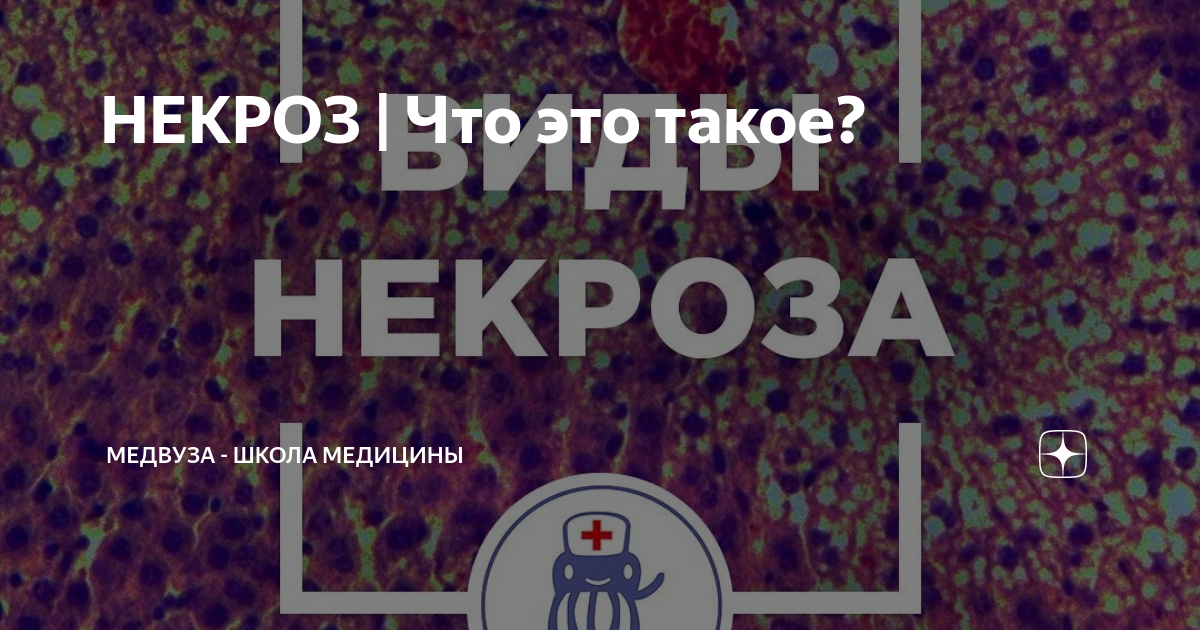Некроз это простыми словами