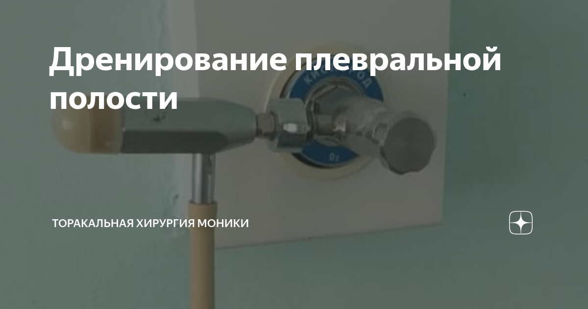 Дренирование плевральной полости | Торакальная хирургия МОНИКИ | Дзен