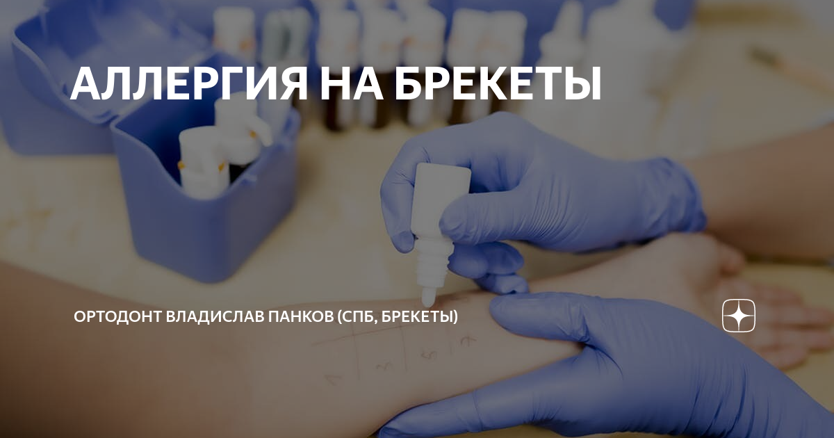АЛЛЕРГИЯ НА БРЕКЕТЫ | Proxima Clinic I Ортодонтия и стоматология I СПб ...