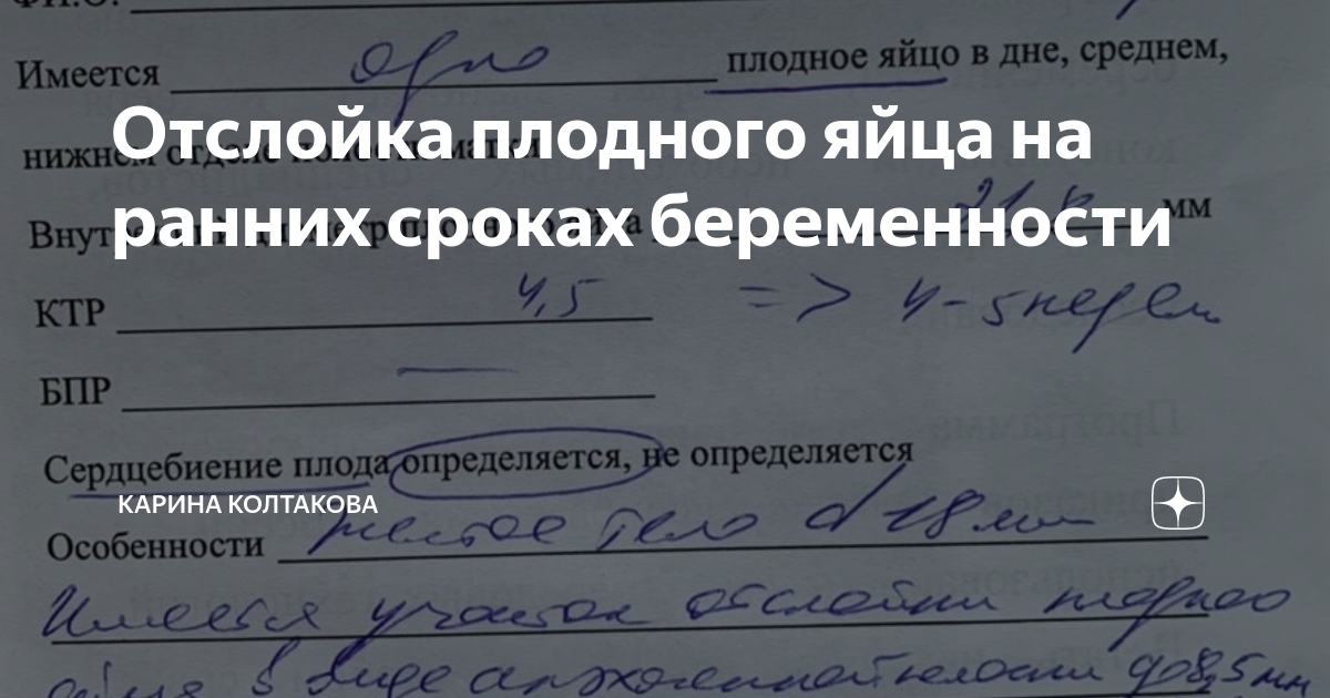 Курила на ранних сроках беременности. Повестка в военкомат. Пришла повестка в военкомат.