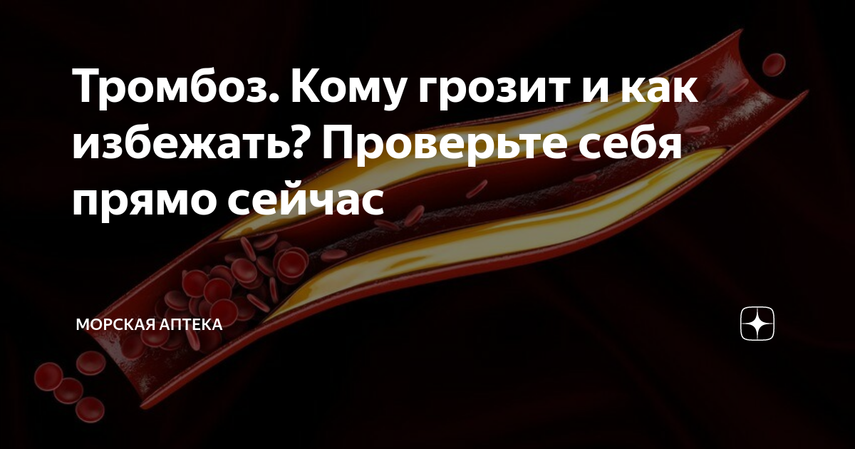 Тромбоз. Кому грозит и как избежать? Проверьте себя прямо сейчас ...