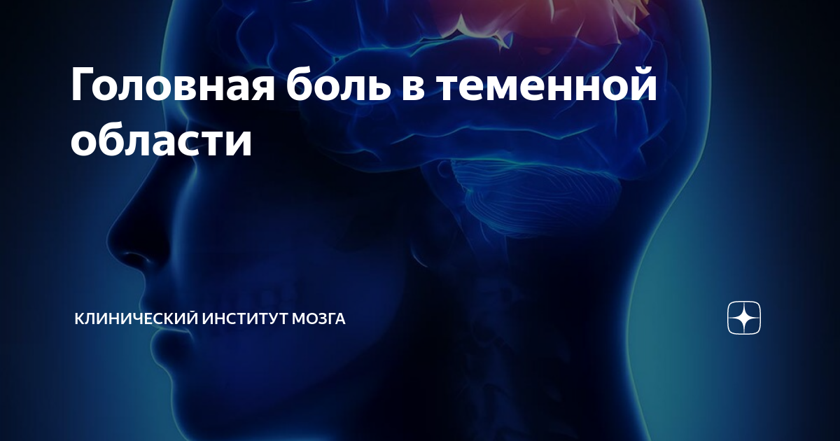 Головная боль в теменной области | Клинический Институт Мозга | Дзен