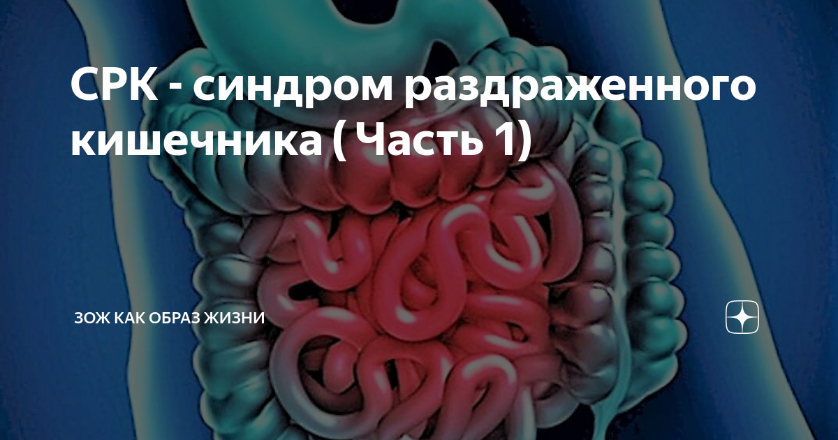 Спазмы кишечника у ребенка. Раздраженный кишечник. Спазмирована сигмовидная кишка. Терапия синдрома раздраженного кишечника.