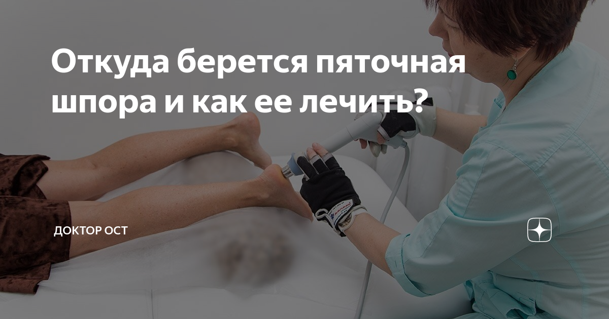 Откуда берется пяточная шпора и как ее лечить? | Доктор ОСТ | Центр ...