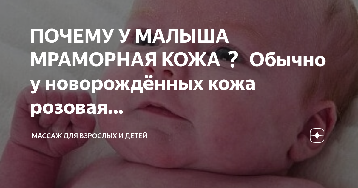 У ребенка мраморная кожа! — 17 ответов | форум Babyblog