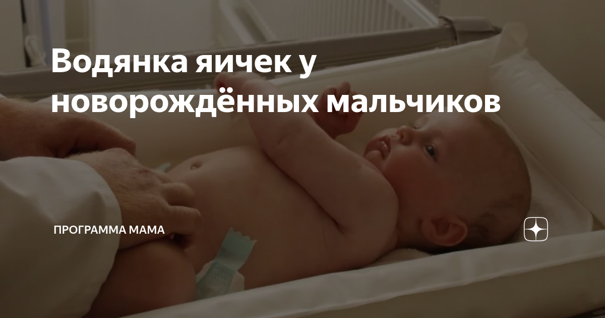 Мальчики большие яички. Водянка яичкк у новорождённых. Гидроцеле у новорожденных мальчиков. Яички у новорожденных детей. Водянка яичек у грудничков мальчиков.