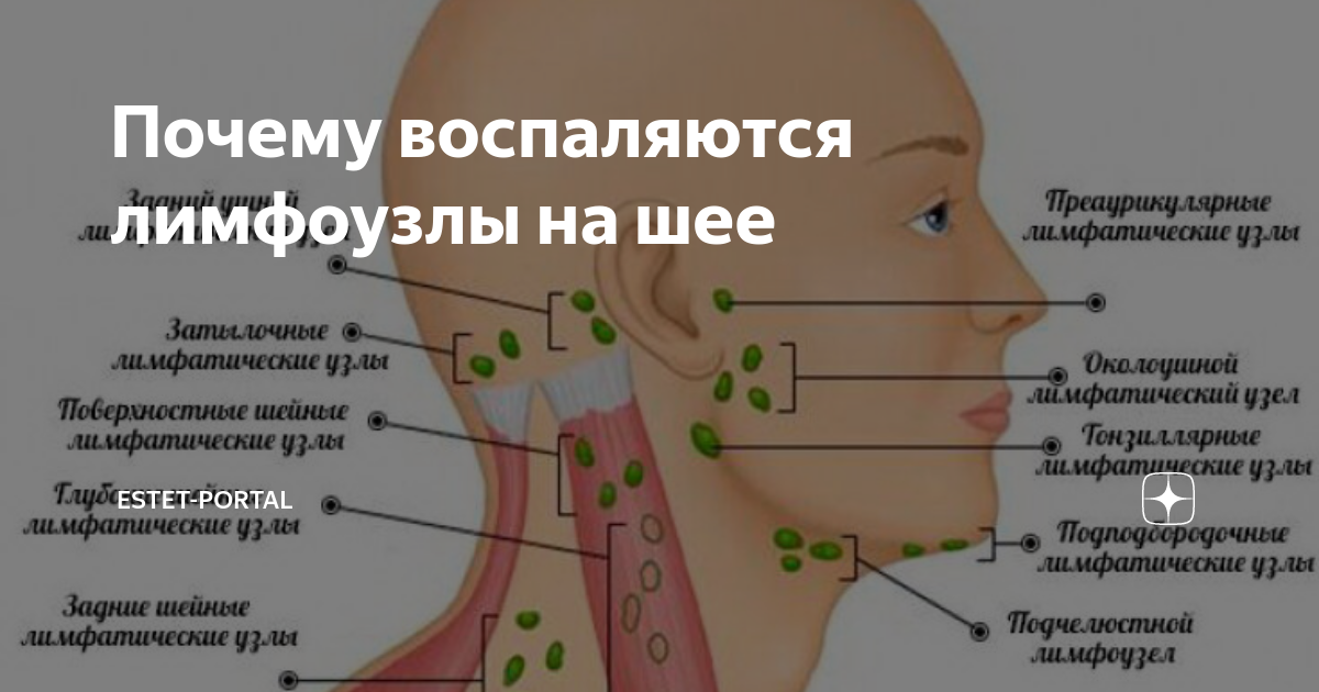 Почему воспаляются лимфоузлы на шее и что с этим делать - Лайфхакер