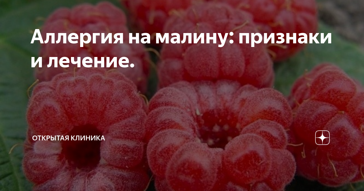 Аллергия на малину у ребенка как выглядит