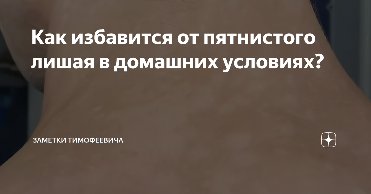 как избавится от розового лишая в домашних условиях