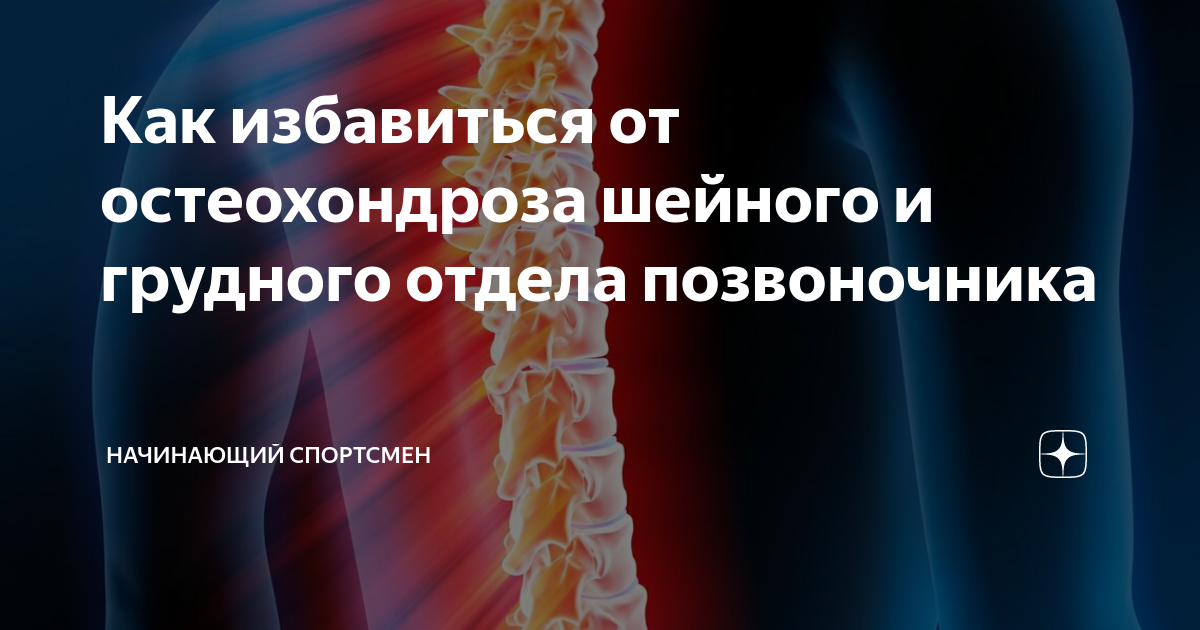 Как избавиться от остеохондроза. Мази от остеохондроза шейного отдела позвоночника и грудного отдела. Остеохондроз шейного отдела и грудного отдела. Мазь при остеохондрозе грудного отдела. Мазь для остеохондроза грудного отдела позвоночника