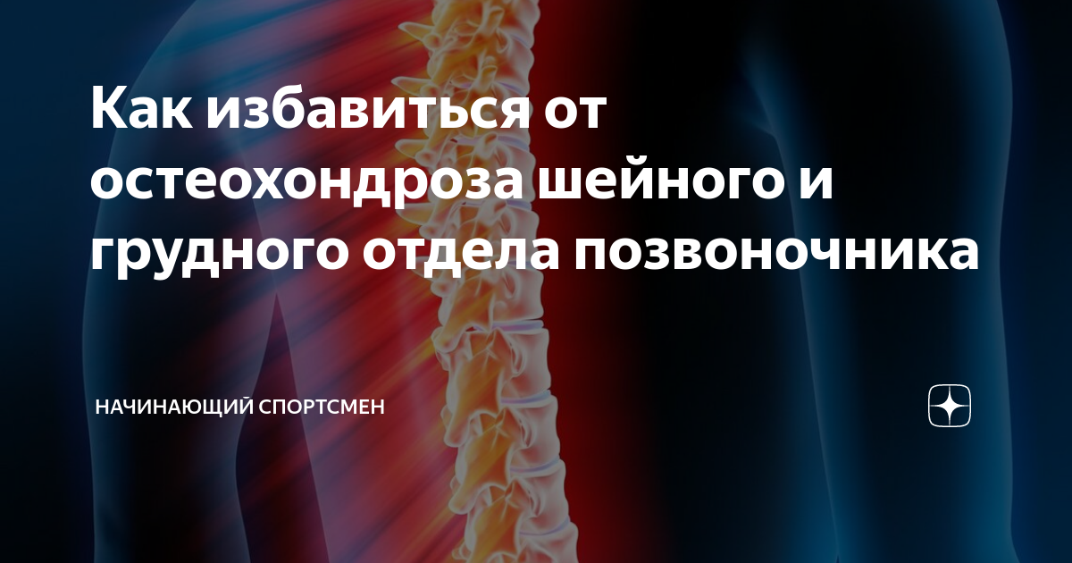 Как избавиться от остеохондроза. Мази от остеохондроза шейного отдела позвоночника и грудного отдела. Остеохондроз шейного отдела и грудного отдела. Мазь при остеохондрозе грудного отдела. Мазь для остеохондроза грудного отдела позвоночника.