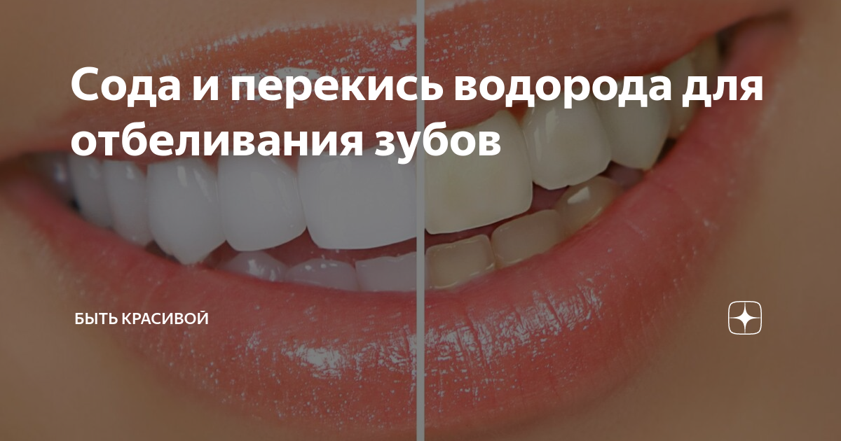 Отбеливание зубов в домашних условиях 🦷 10 лучших способов отбелить зубы дома 👄 | CIS