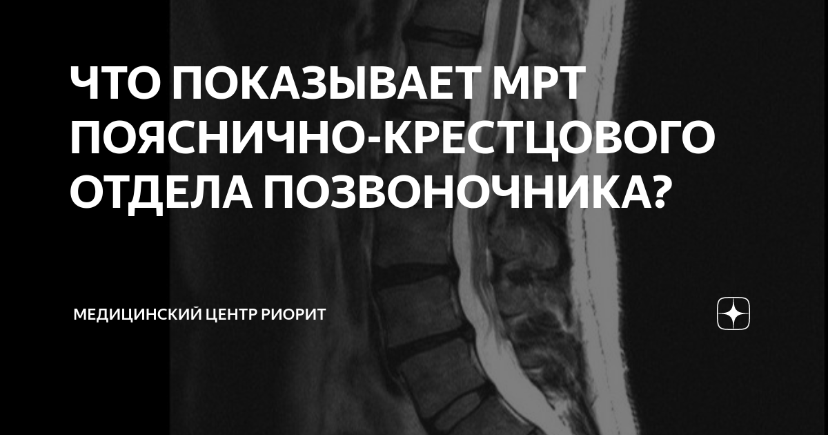 Как делают мрт пояснично крестцового отдела в одежде или нет