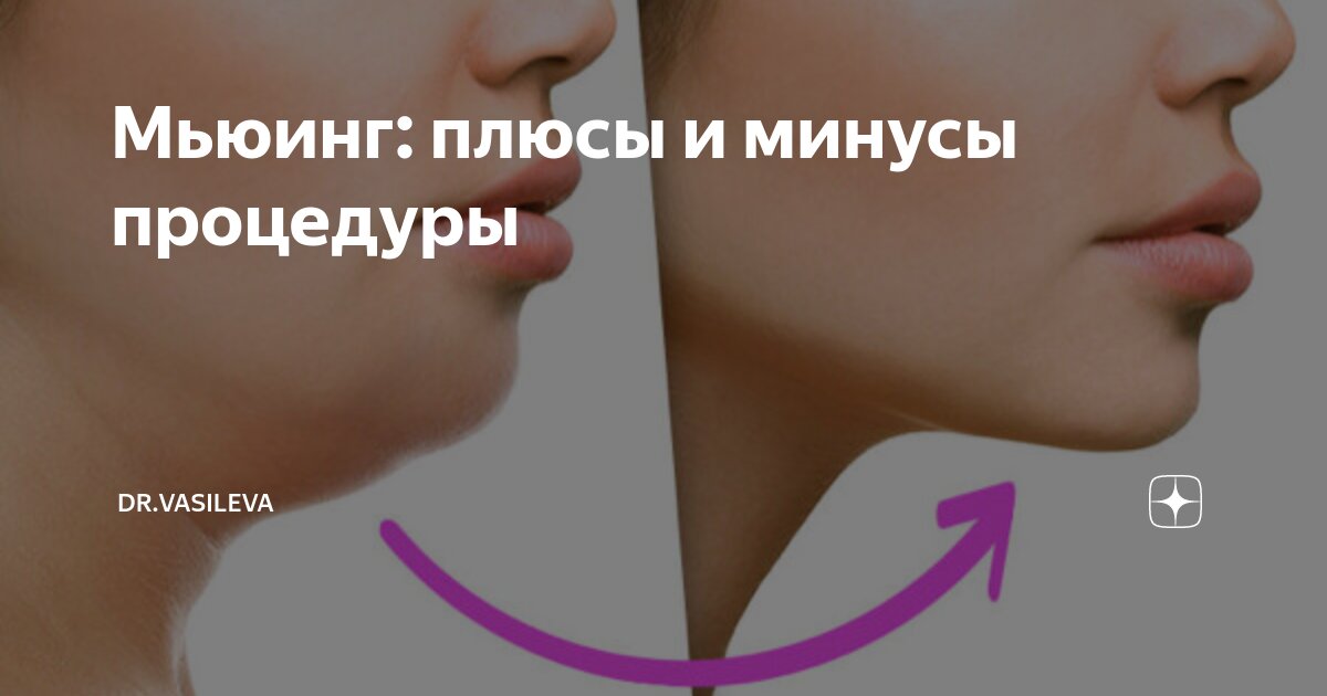 Мьюинг это. Мьюинг. Мьюинг упражнения. Мьюинг до после. Мьюинг картинки.