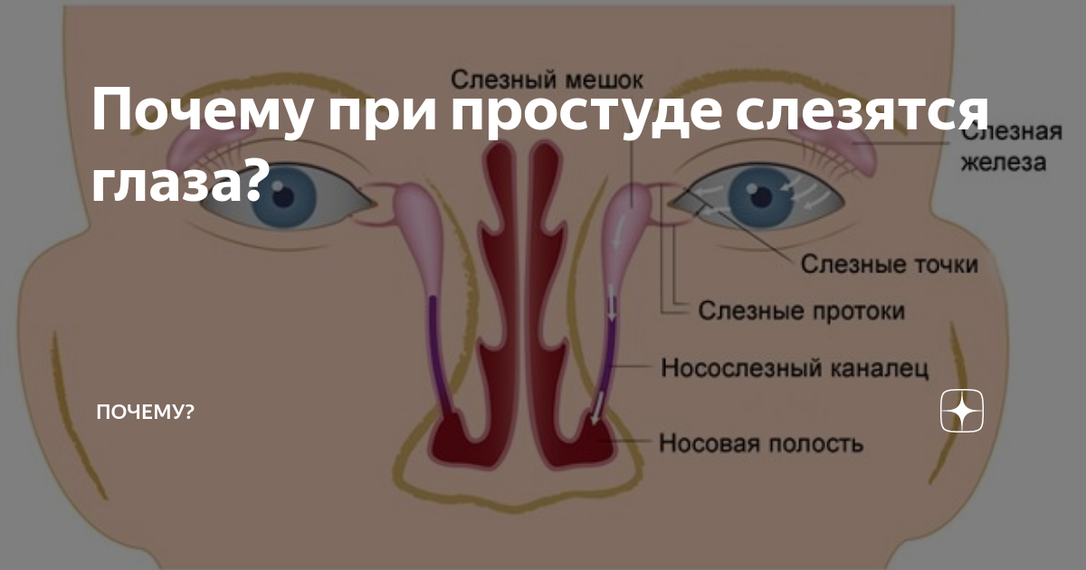 Почему течет глаз у взрослого. Текут слезы при простуде. Причины слезотечения глаза.