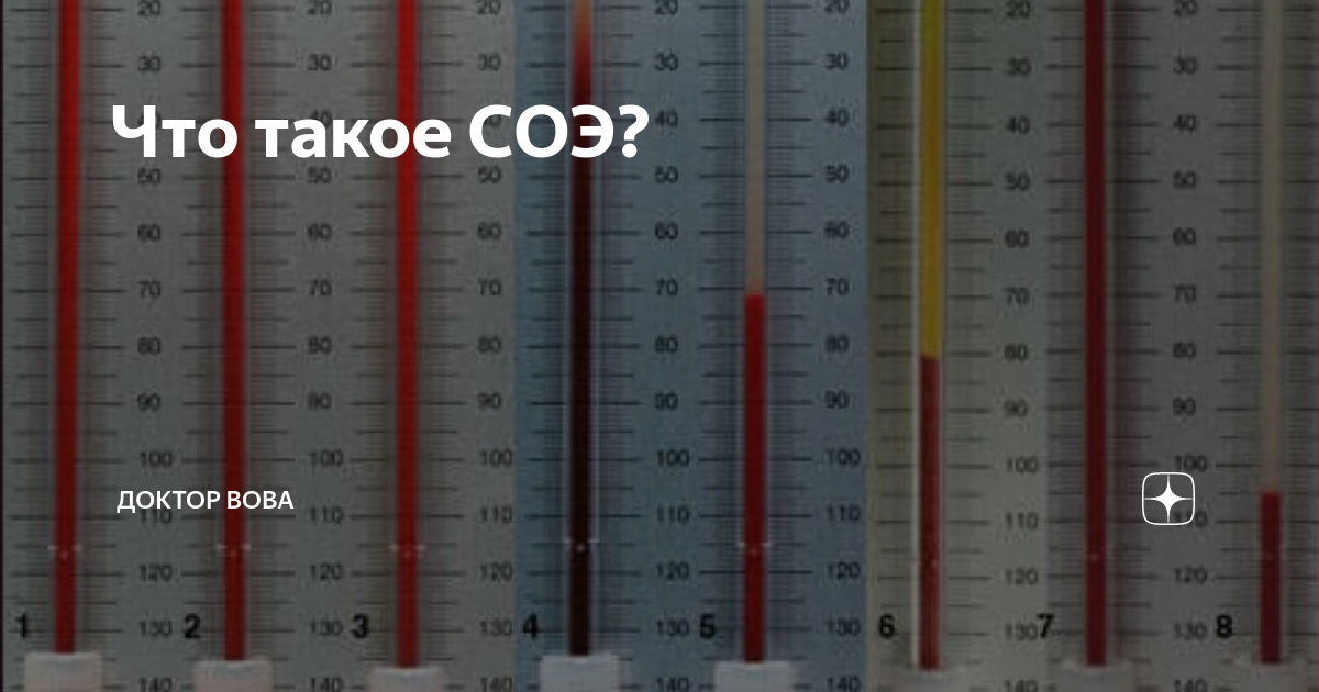 Соэ 1 мм. Синдром ускоренной СОЭ. СОЭ 250-300. СОЭ-1200
