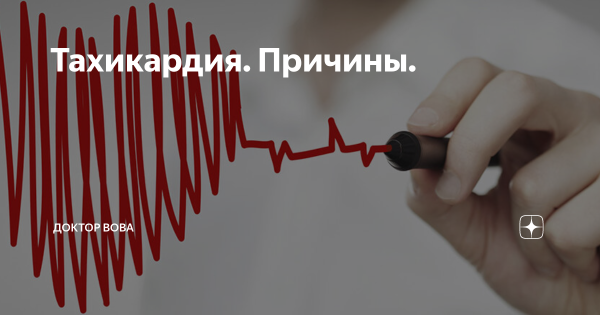 Сбился сердечный. Сбивается ритм сердца. Почему сердце иногда сбивается с ритма. Сильно сбился сердечный ритм. Сбивается ритм сердца на несколько секунд