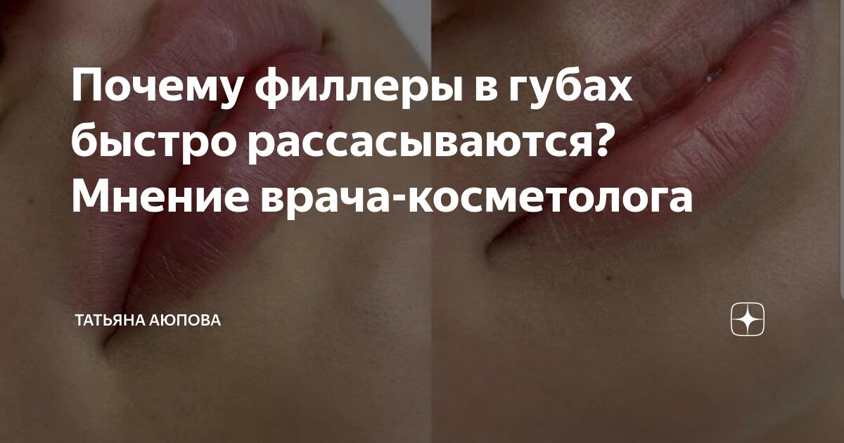 можно ли растворить не весь филлер в губах