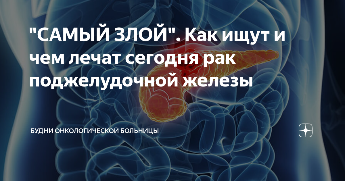 онкологические заболевания болезни. навык и умение различие. рак успешно лечится. лечится ли рпк легкого. методика лечения.