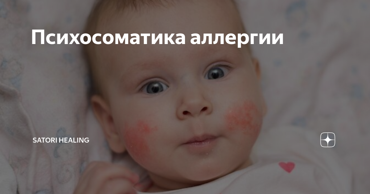 аллергия на холод психосоматика