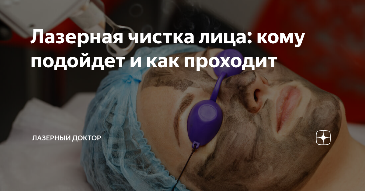 Лазерная чистка лица: кому подойдет и как проходит | Лазерный Доктор | Дзен