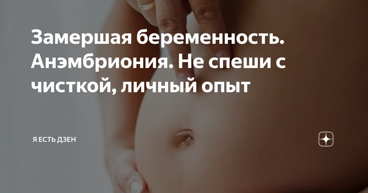 Замершая беременность где. Замершая беременность где. Признаки замершей беременности на узи. Замершая беременность сроки. Замершая беременность где.