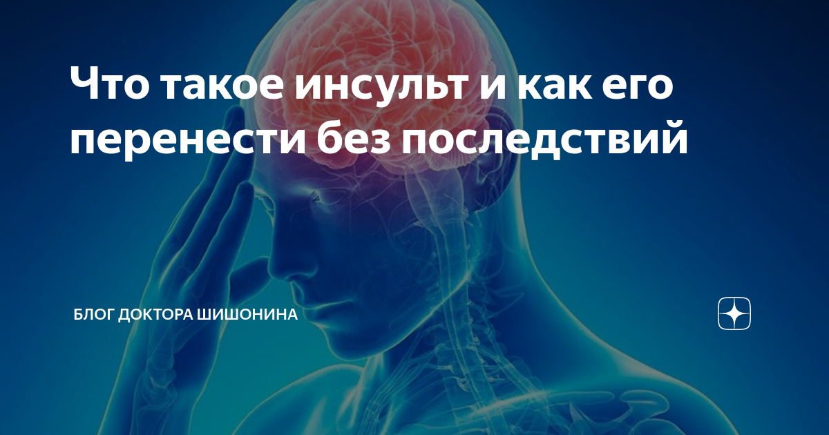 Что такое инсульт и как его перенести без последствий | Блог Доктора ...
