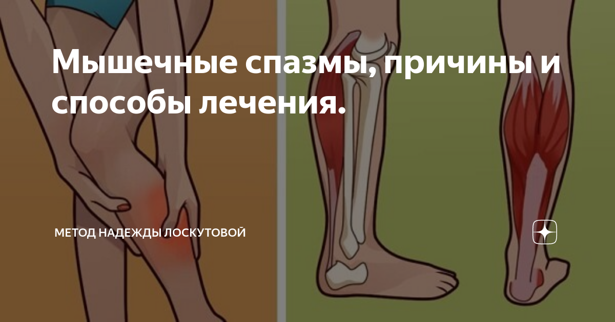 Ноги сводят судороги причины лечение у мужчин. Народное средство от судорог конечностей. Судороги в ногах причины.