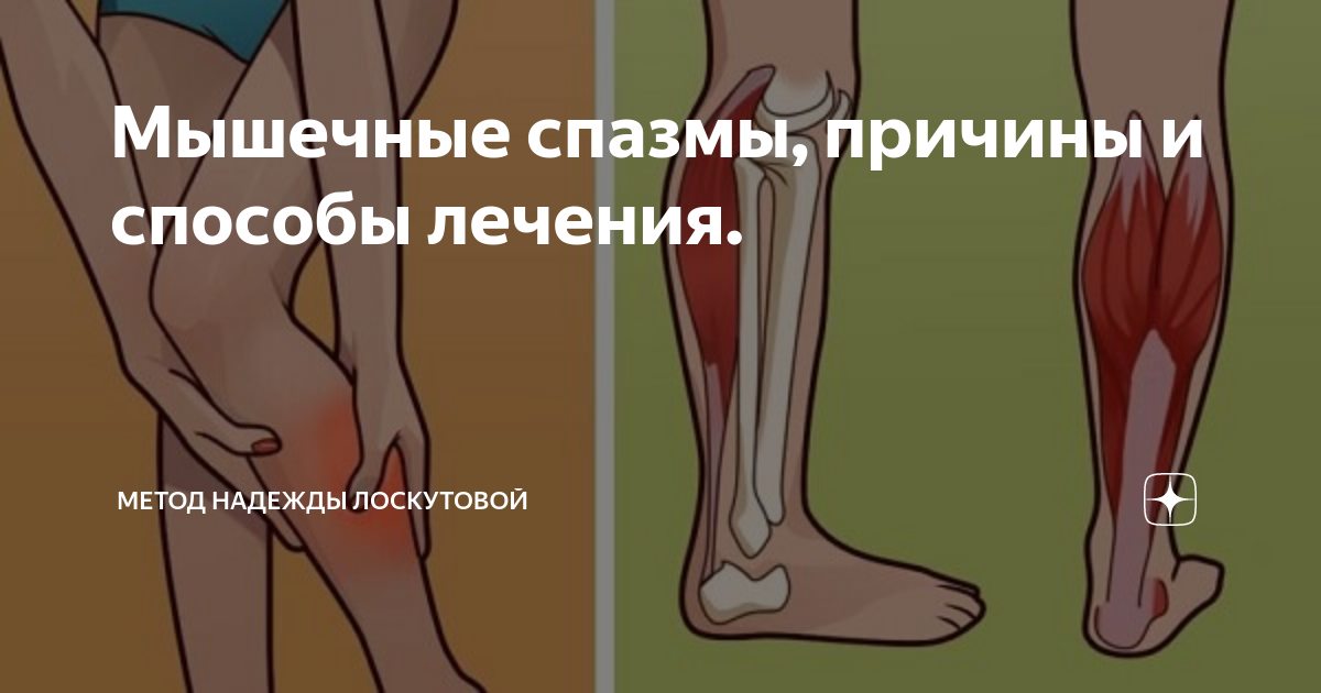 Судорога левой ноги причины. При судорогах в ногах. Судорога икроножной мышцы.