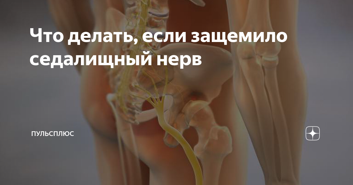 Люмбоишиалгия поясничного отдела. Люмбоишиалгия поясничного отдела позвоночника. Люмбоишиалгия справа что это. Вертеброгенная люмбалгия. Люмбоишиалгия справа что это.
