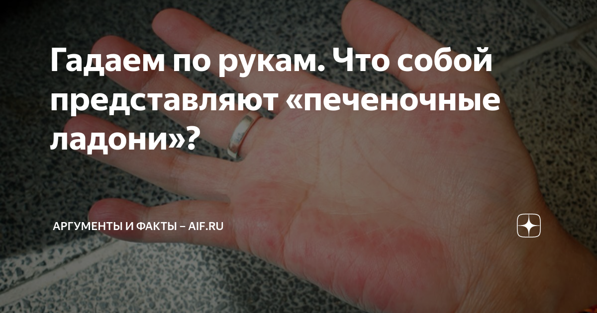 Гадаем по рукам. Что собой представляют «печеночные ладони ...