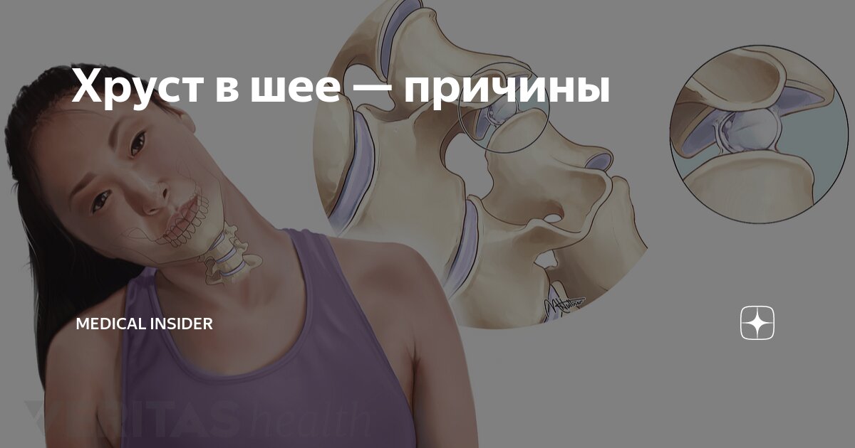 Причины хруста и боли в коленях. Названы неожиданные причины хруста в коленях Как избавиться от хруста в коленях, что делать если хрустят коленные. Бальзам Болотова от хруста в коленях | Статьи