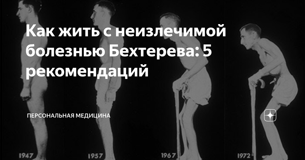 Упражнения при болезни бехтерева в картинках