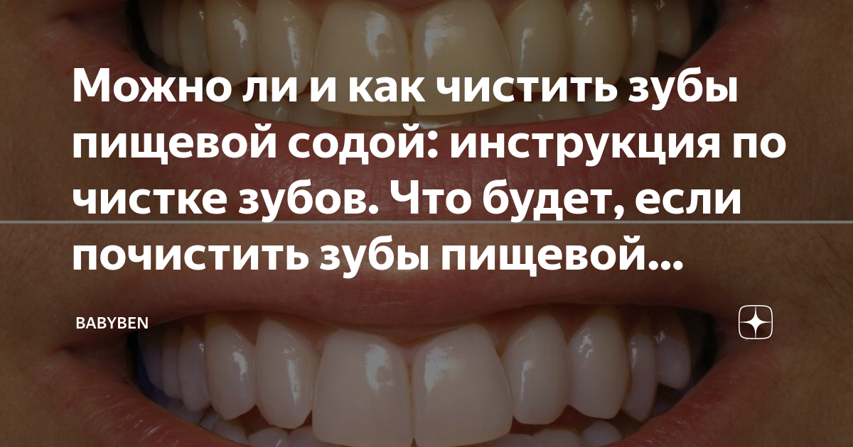 Что будет если чистить зубы содой. Можно ли чистить зубы содой пищевой.