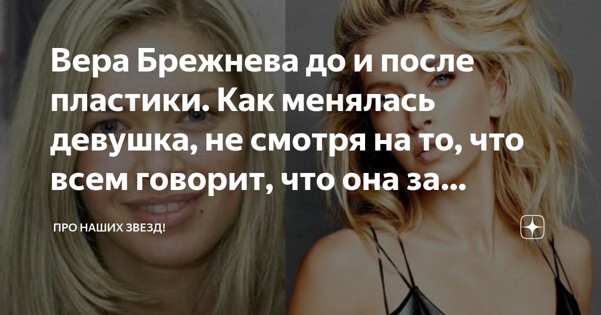 Вера брежнева похудела до и после