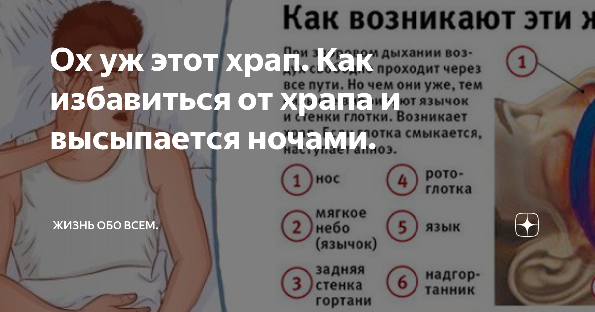 Ох уж этот храп. Как избавиться от храпа и высыпается ночами. | Жизнь обо всем. | Дзен