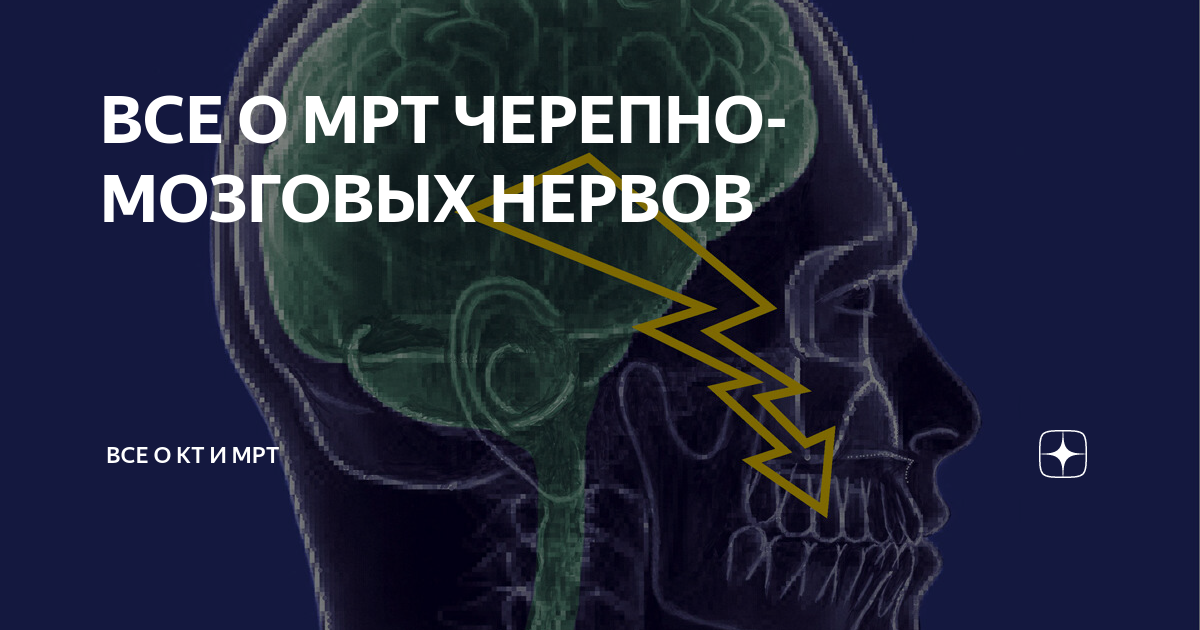 Мрт черепных нервов. Языкоглоточный нерв мрт анатомия. Мрт черепно мозговых нервов. Черепные нервы мрт. Лицевой нерв мрт анатомия.